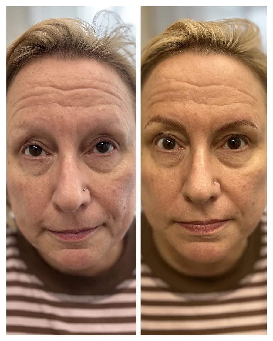 Client before and after brow restoration