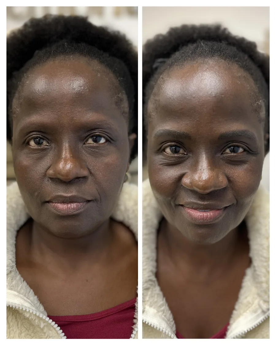 Client before and after brow restoration