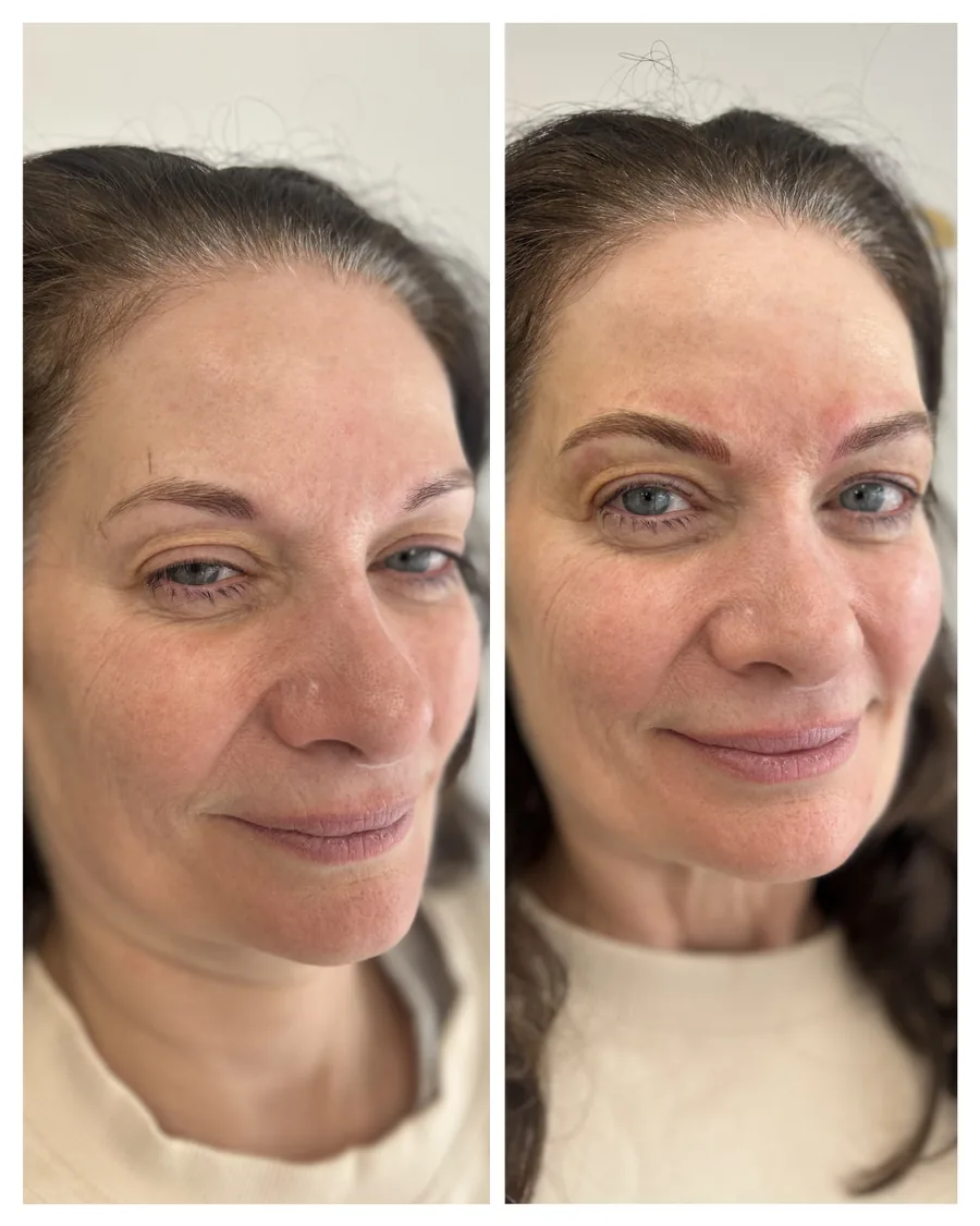 Client before and after brow restoration