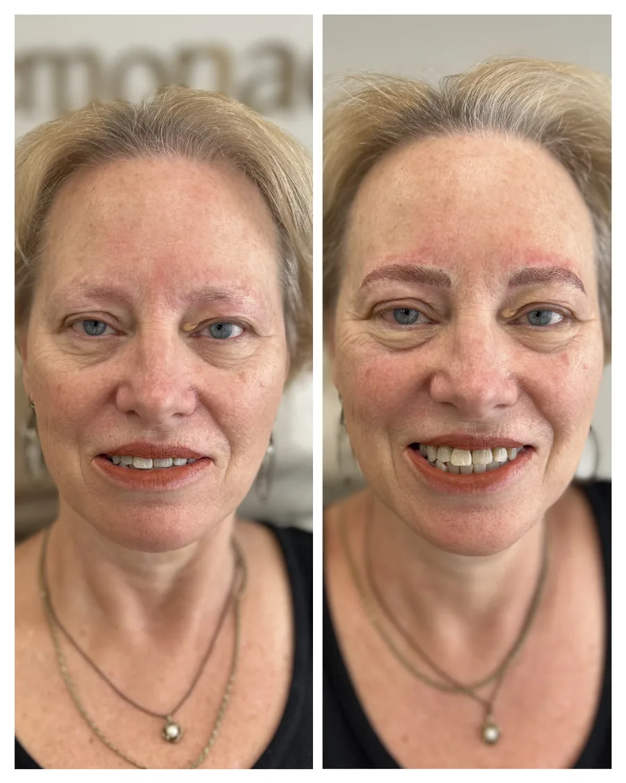 Client before and after brow restoration
