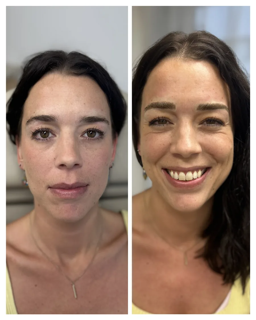 Client before and after brow restoration